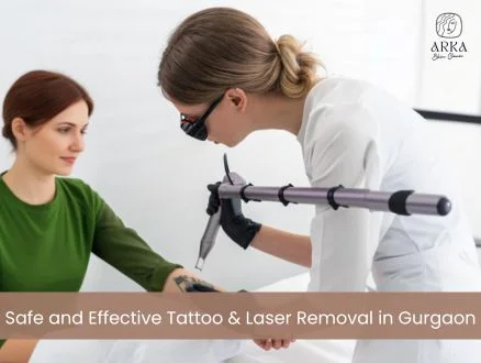 Safe and Effective Tattoo Laser Removal in Gurgaon