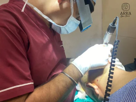 Best Hair Transplant Clinic in Gurugram