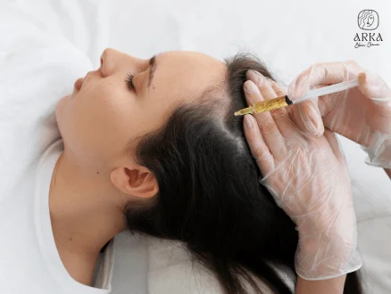 PRP therapy