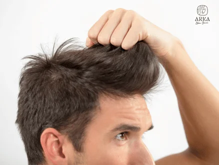 Best Age for Hair Transplant When Should You Consider It