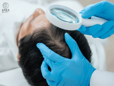 Losing Hair Fast Best Hair Loss Treatment India